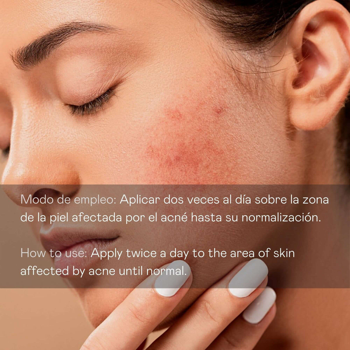 Sérum Facial Antiimperfecciones Directo – Acción Intensiva - 30 ml Valquer®