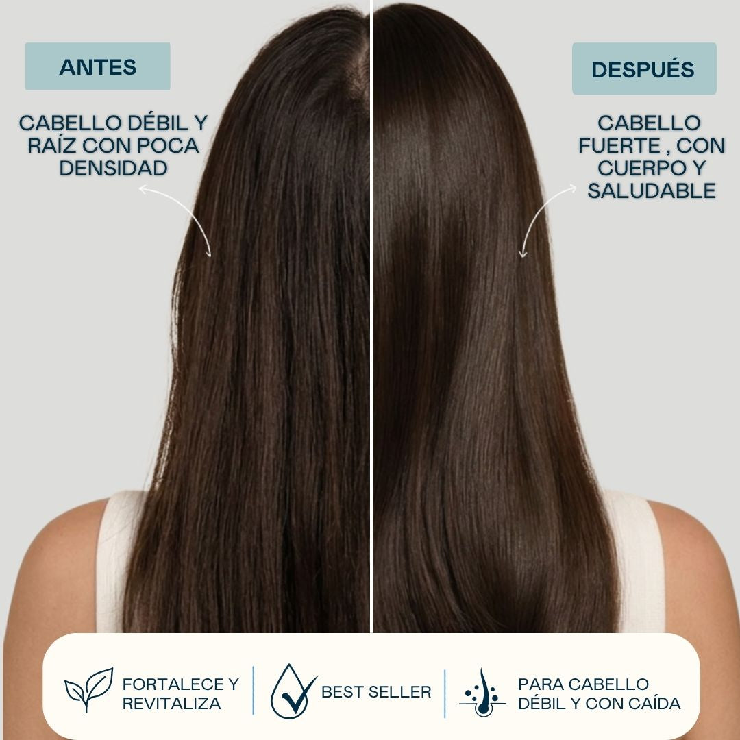 Shock Caída ADN Molecular – Loción Anticaída Capilar Valquer®